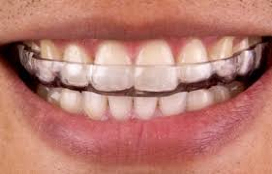 Eklem Plağı Nedir?