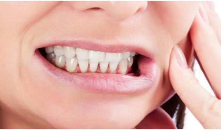 Diş Gıcırdatma Bruksizm Nedir?