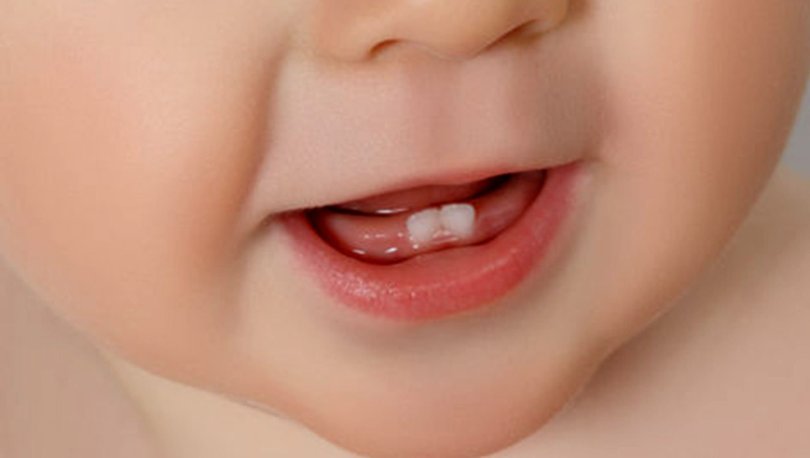 bebeklerde diş çıkarma