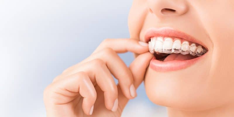 orthodontic treatments in turkey